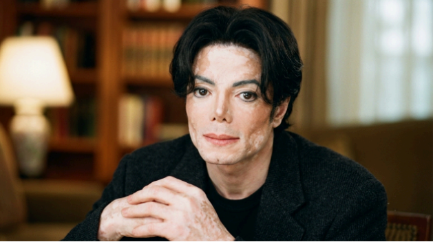 why did Michael Jackson turn white